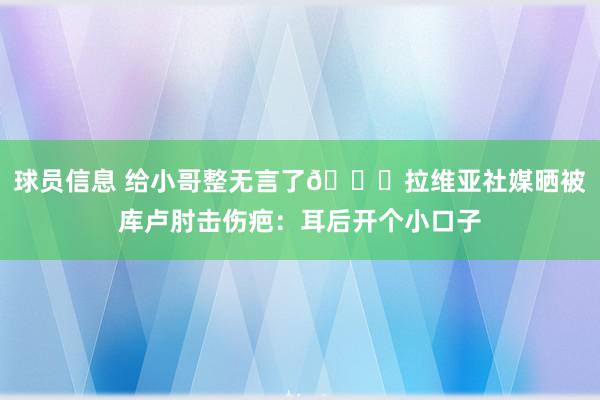 球员信息 给小哥整无言了😅拉维亚社媒晒被库卢肘击伤疤：耳后开个小口子